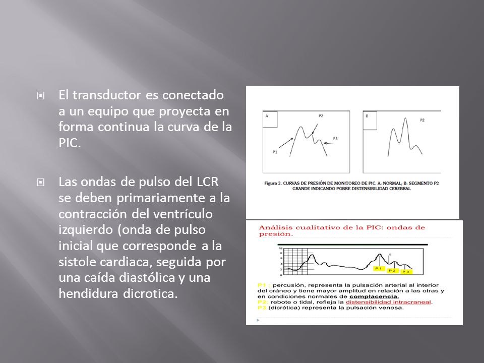 El transductor es conectado a un equipo que proyecta en forma continua la curva de la PIC.