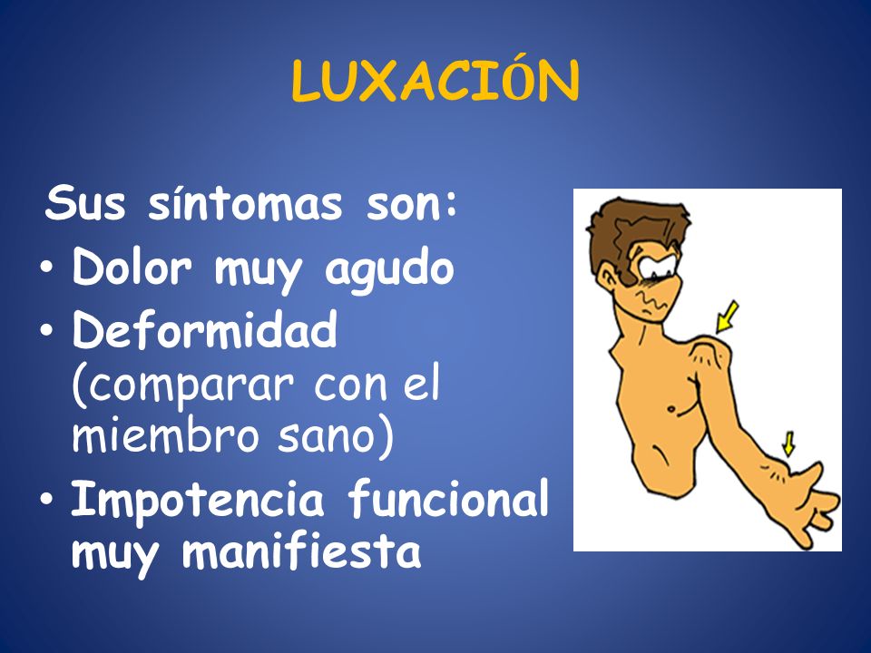 LUXACIÓN Dolor muy agudo Deformidad (comparar con el miembro sano)
