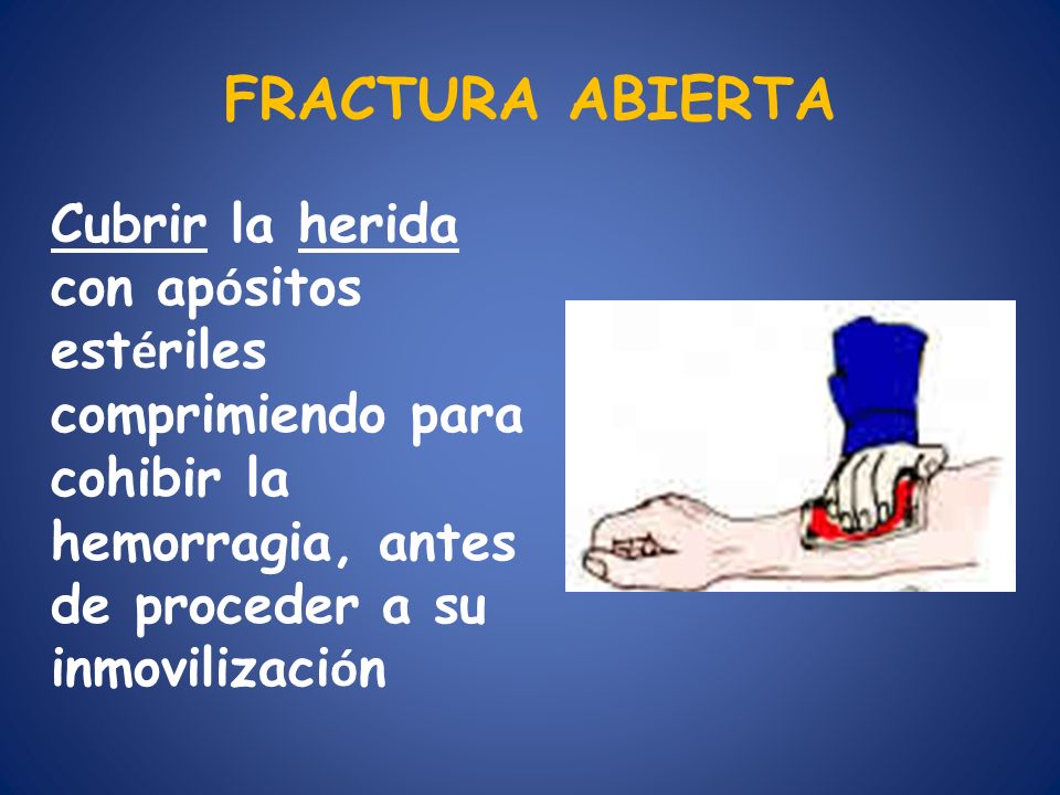 FRACTURA ABIERTA Cubrir la herida con apósitos estériles comprimiendo para cohibir la hemorragia, antes de proceder a su inmovilización.