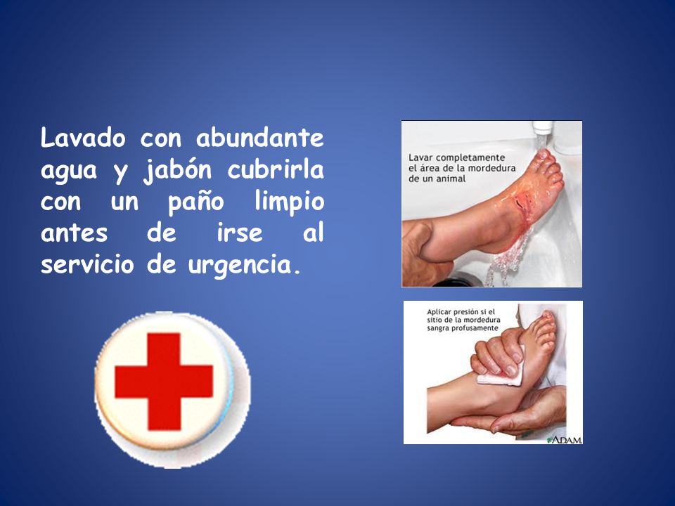 Lavado con abundante agua y jabón cubrirla con un paño limpio antes de irse al servicio de urgencia.