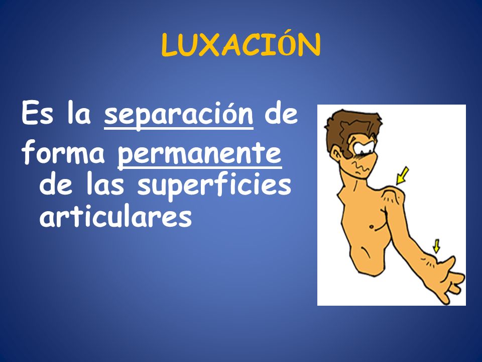 LUXACIÓN Es la separación de forma permanente de las superficies articulares