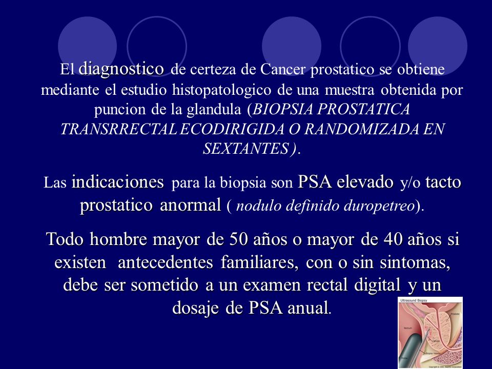 El diagnostico de certeza de Cancer prostatico se obtiene mediante el estudio histopatologico de una muestra obtenida por puncion de la glandula (BIOPSIA PROSTATICA TRANSRRECTAL ECODIRIGIDA O RANDOMIZADA EN SEXTANTES ).