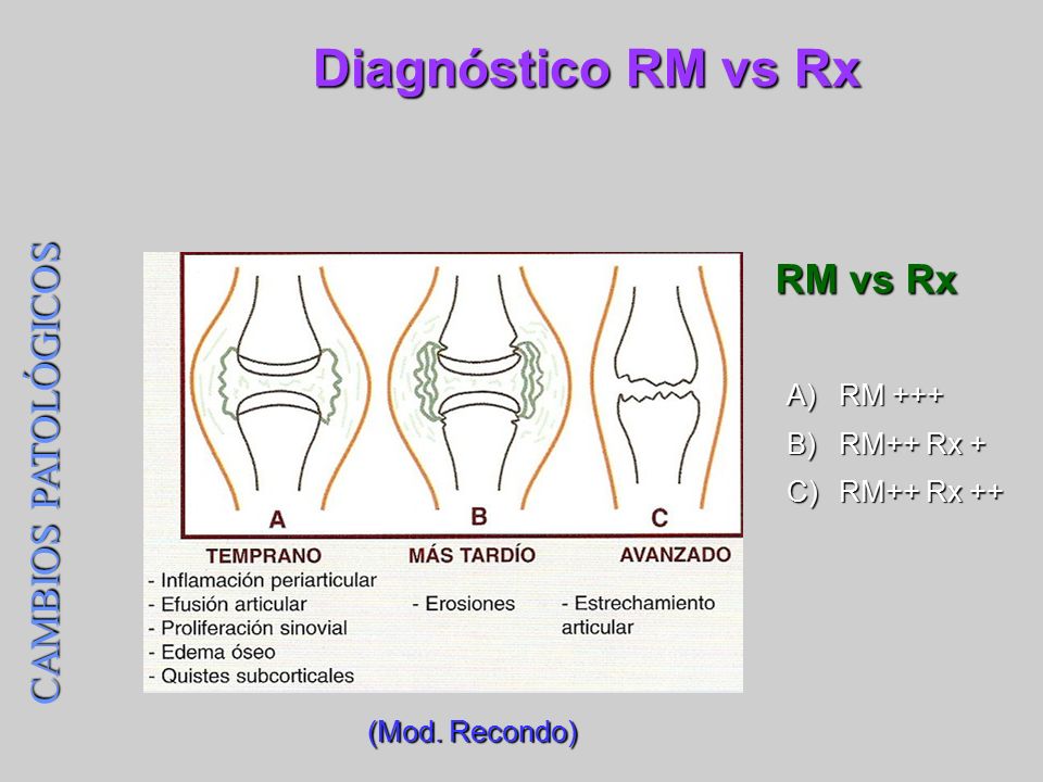 Diagnóstico RM vs Rx RM vs Rx CAMBIOS PATOLÓGICOS RM +++ RM++ Rx +