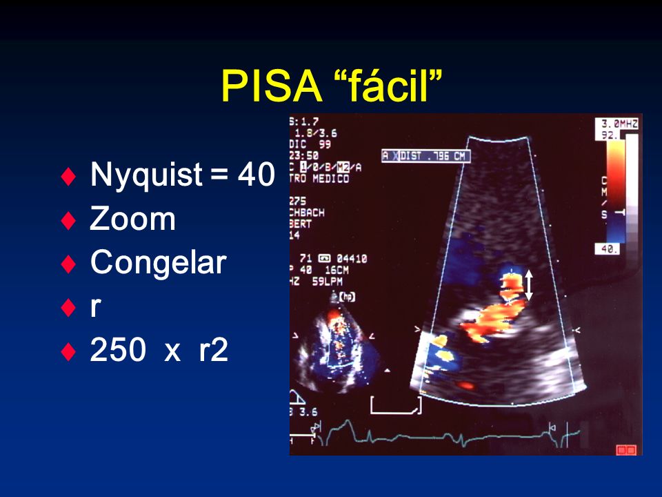 PISA fácil Nyquist = 40 Zoom Congelar r 250 x r2
