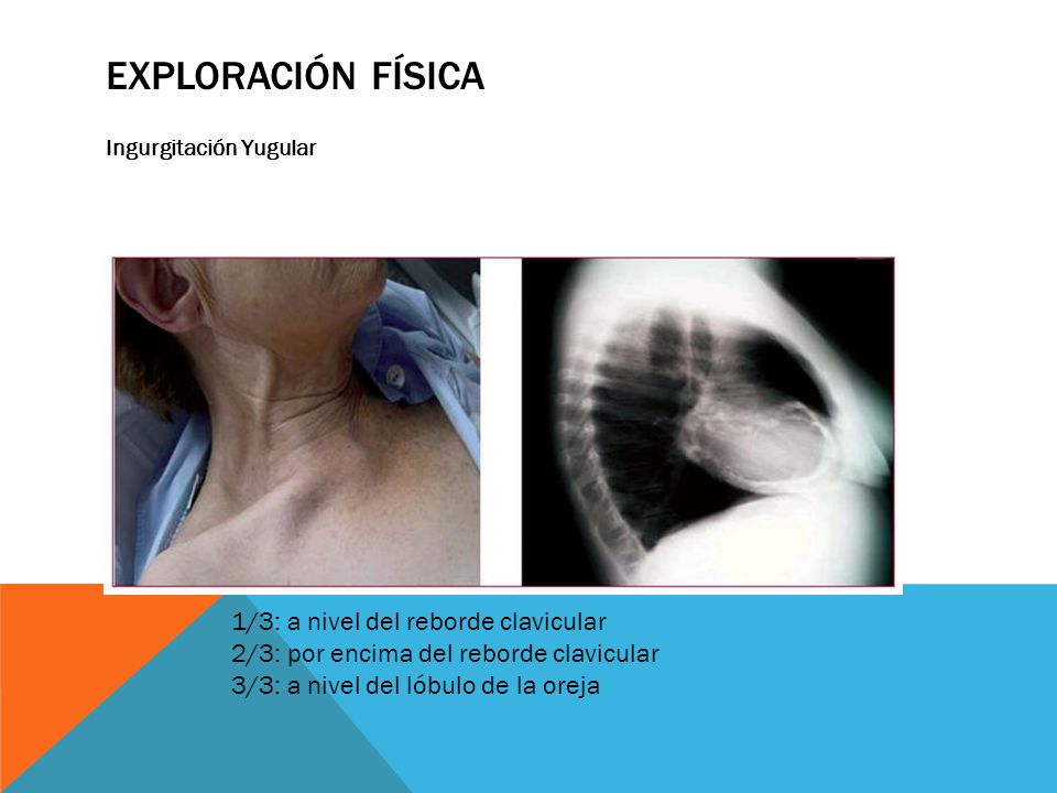 Exploración física 1/3: a nivel del reborde clavicular