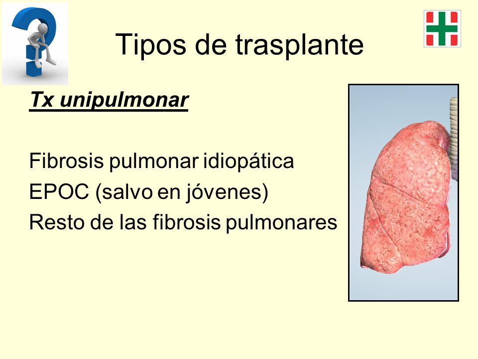 Tipos de trasplante Tx unipulmonar Fibrosis pulmonar idiopática
