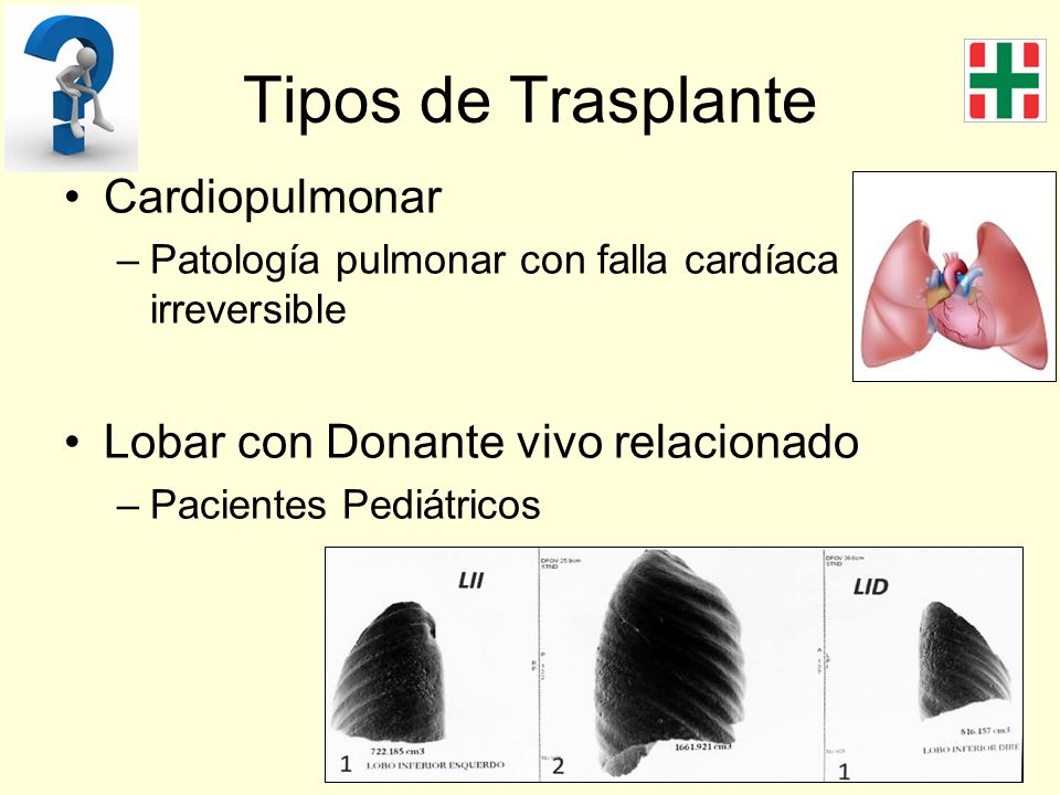 Tipos de Trasplante Cardiopulmonar Lobar con Donante vivo relacionado