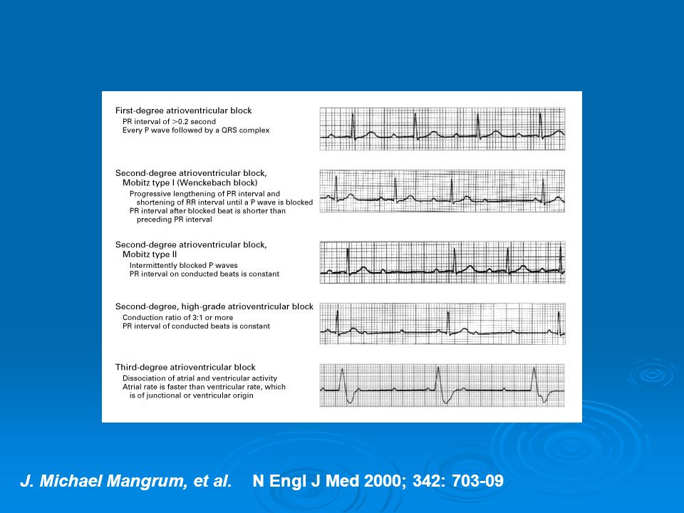 J. Michael Mangrum, et al. N Engl J Med 2000; 342: