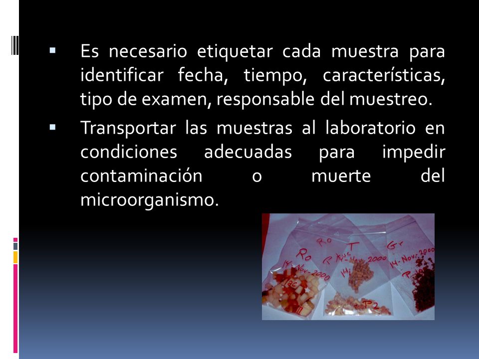 Es necesario etiquetar cada muestra para identificar fecha, tiempo, características, tipo de examen, responsable del muestreo.