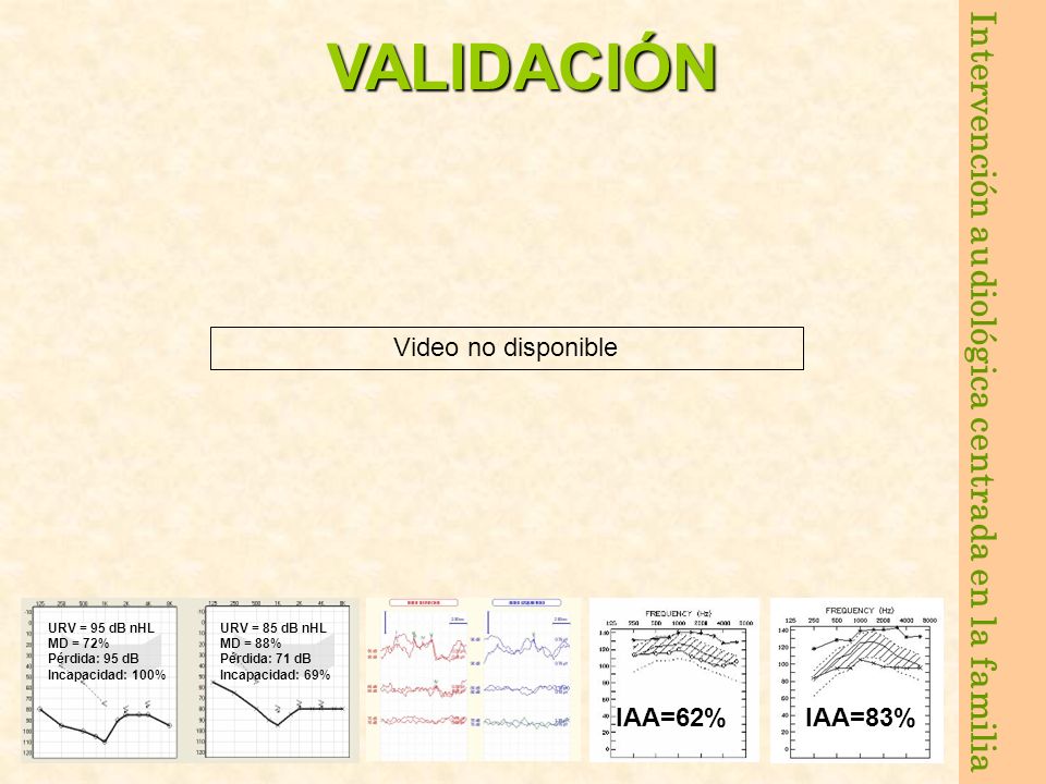 VALIDACIÓN Video no disponible IAA=62% IAA=83% URV = 95 dB nHL