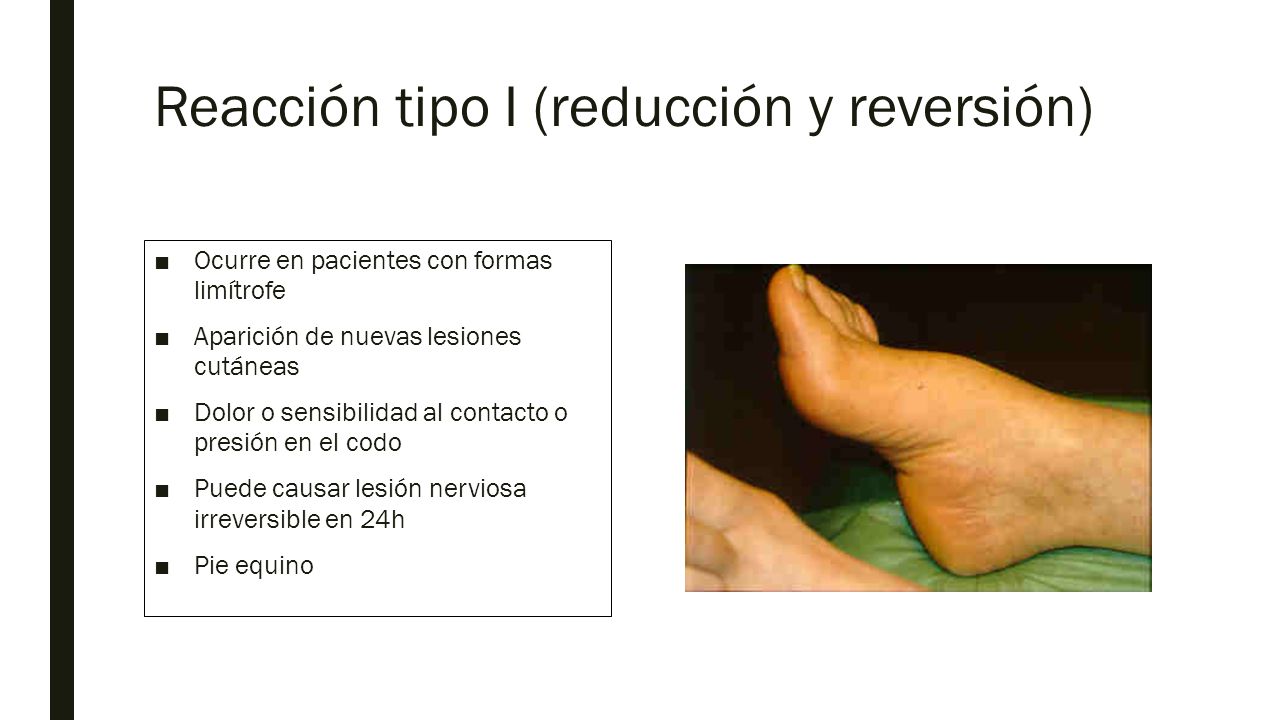 Reacción tipo I (reducción y reversión)