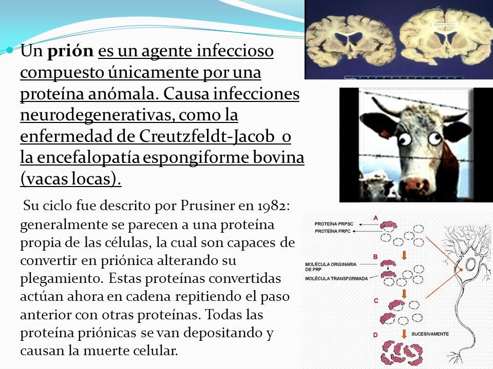 Un prión es un agente infeccioso compuesto únicamente por una proteína anómala. Causa infecciones neurodegenerativas, como la enfermedad de Creutzfeldt-Jacob o la encefalopatía espongiforme bovina (vacas locas).