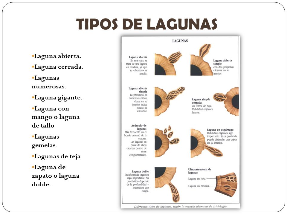 TIPOS DE LAGUNAS Laguna abierta. Laguna cerrada. Lagunas numerosas.