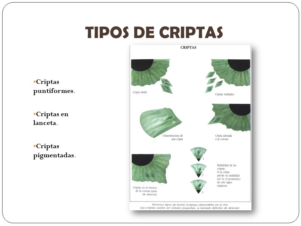 TIPOS DE CRIPTAS Criptas puntiformes. Criptas en lanceta.