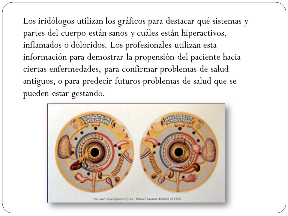 Los iridólogos utilizan los gráficos para destacar qué sistemas y partes del cuerpo están sanos y cuáles están hiperactivos, inflamados o doloridos.