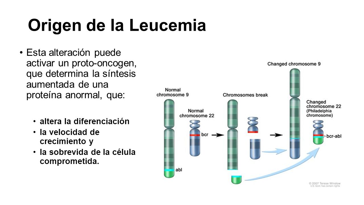 Origen de la Leucemia Esta alteración puede activar un proto-oncogen, que determina la síntesis aumentada de una proteína anormal, que: