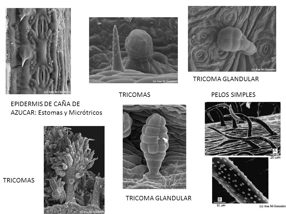 TRICOMA GLANDULAR TRICOMAS. PELOS SIMPLES. EPIDERMIS DE CAÑA DE AZUCAR: Estomas y Micrótricos. TRICOMAS.
