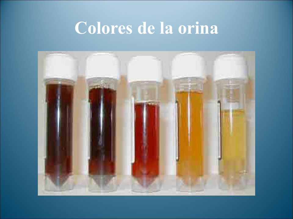 Colores de la orina