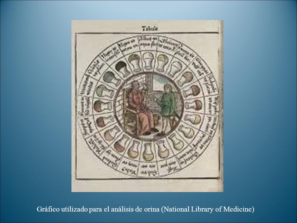 Gráfico utilizado para el análisis de orina (National Library of Medicine)