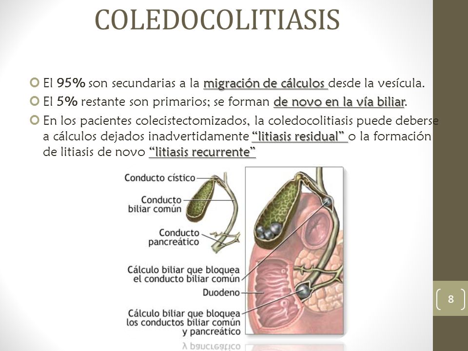 COLEDOCOLITIASIS El 95% son secundarias a la migración de cálculos desde la vesícula.