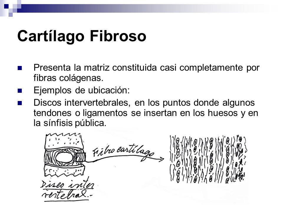 Cartílago Fibroso Presenta la matriz constituida casi completamente por fibras colágenas. Ejemplos de ubicación: