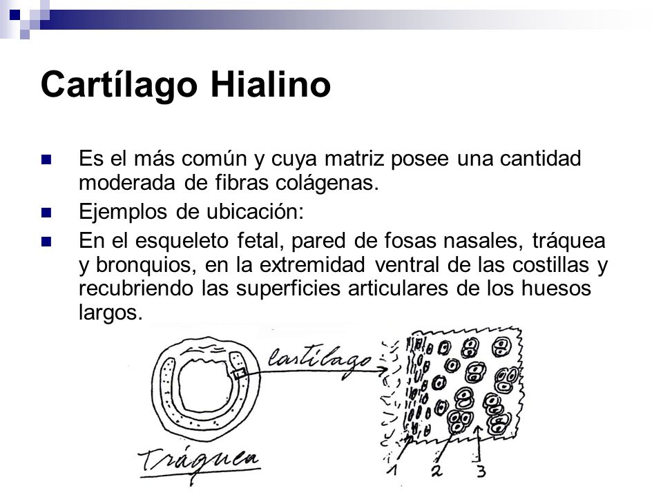 Cartílago Hialino Es el más común y cuya matriz posee una cantidad moderada de fibras colágenas. Ejemplos de ubicación: