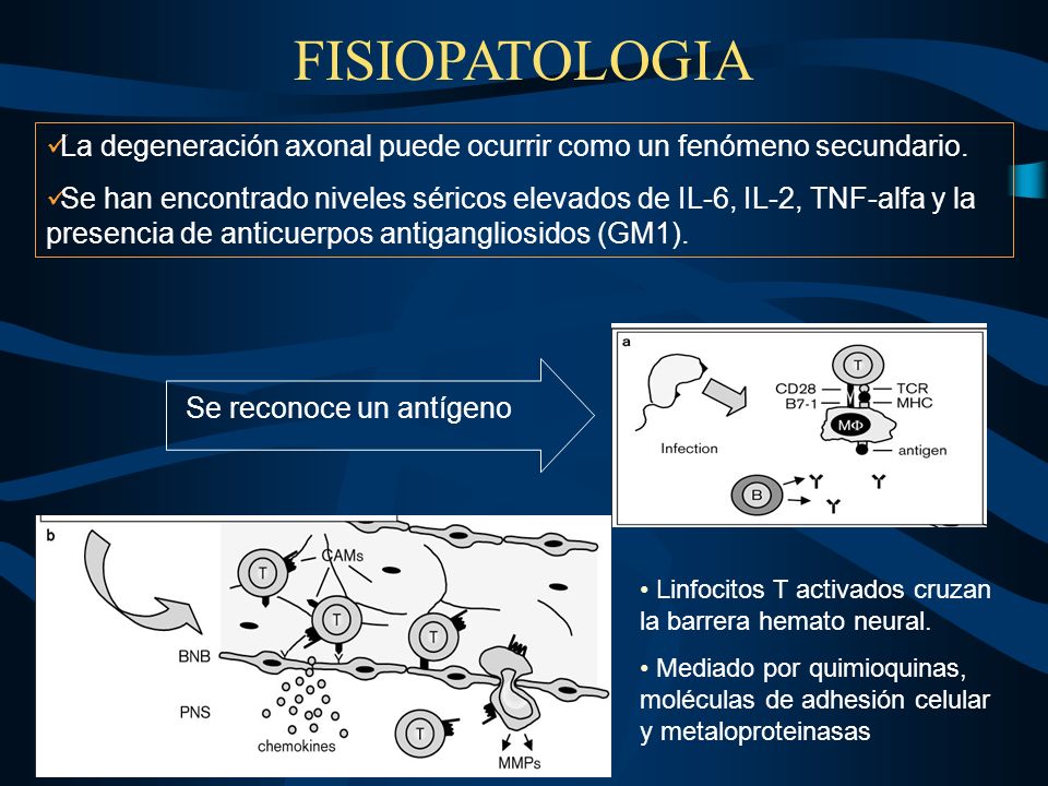 FISIOPATOLOGIA La degeneración axonal puede ocurrir como un fenómeno secundario.