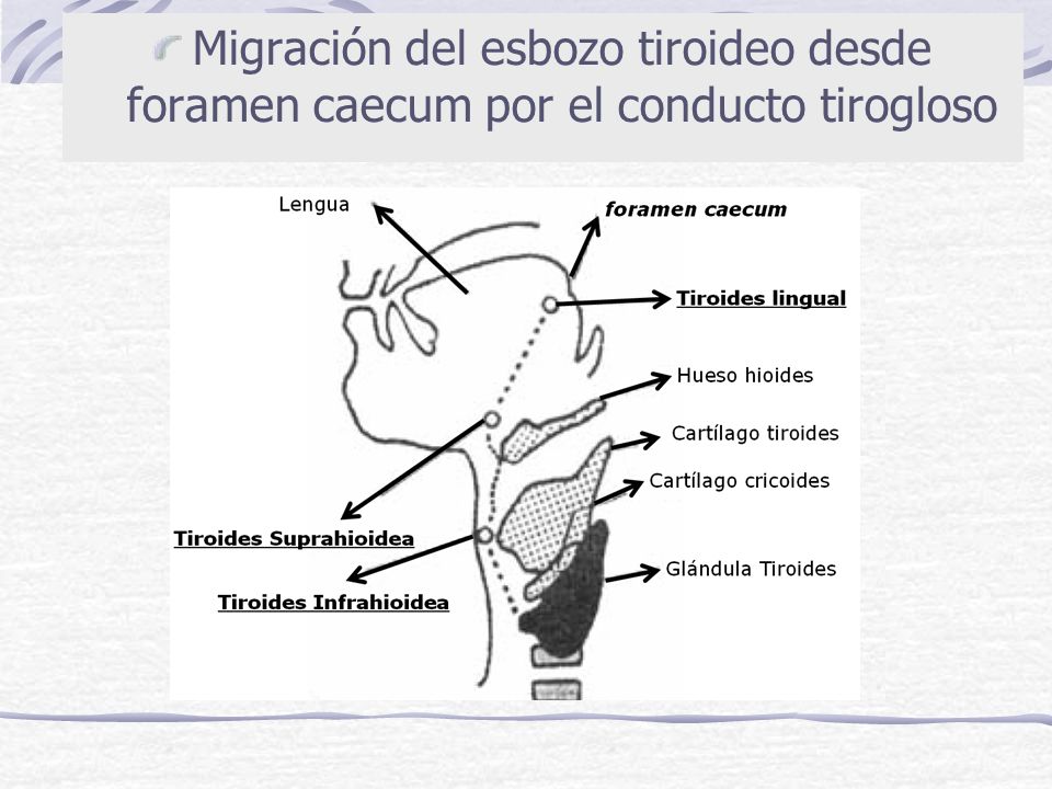 Migración del esbozo tiroideo desde foramen caecum por el conducto tirogloso