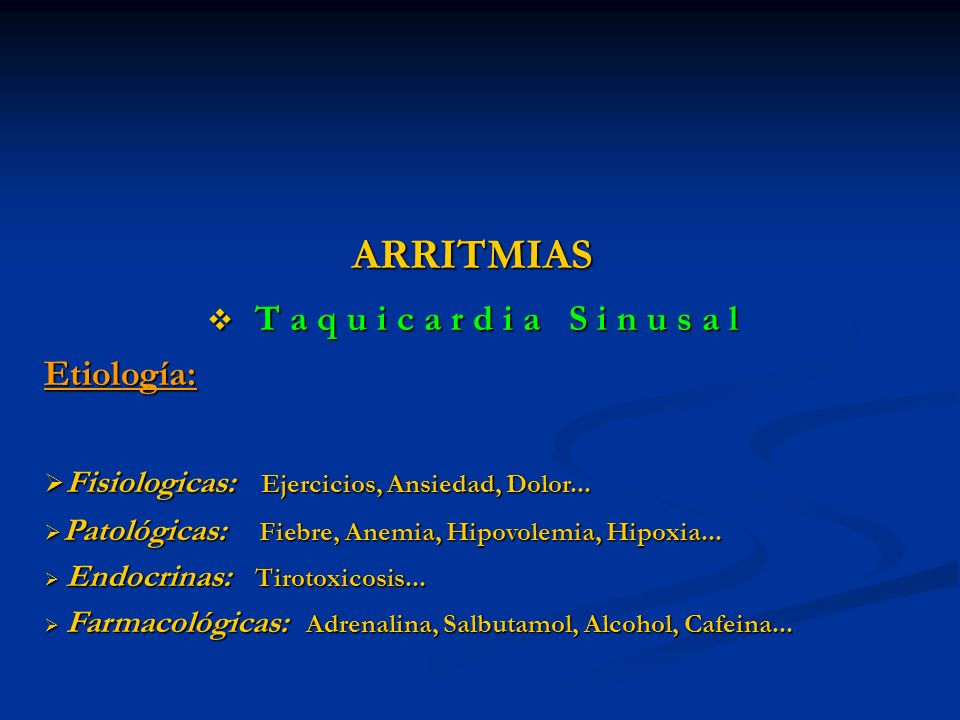 ARRITMIAS T a q u i c a r d i a S i n u s a l