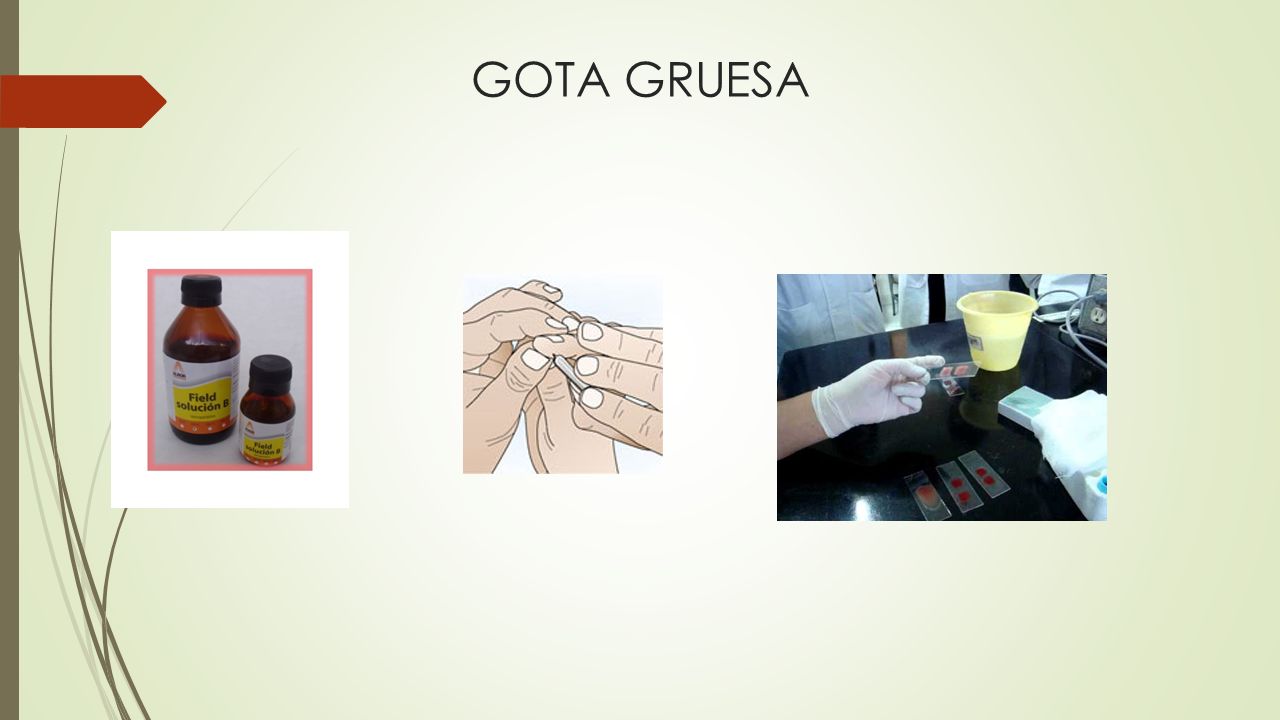 GOTA GRUESA