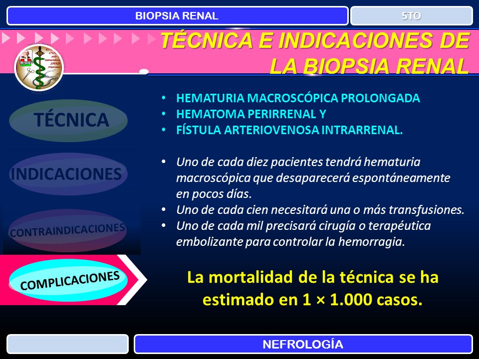 La mortalidad de la técnica se ha estimado en 1 × casos.