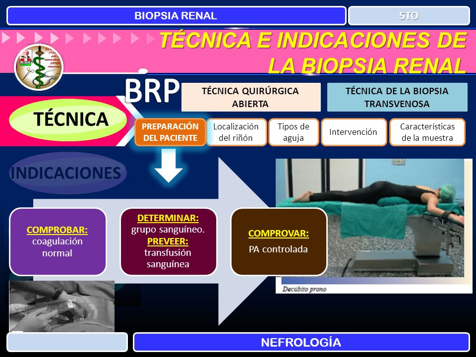 BRP TÉCNICA E INDICACIONES DE LA BIOPSIA RENAL TÉCNICA INDICACIONES