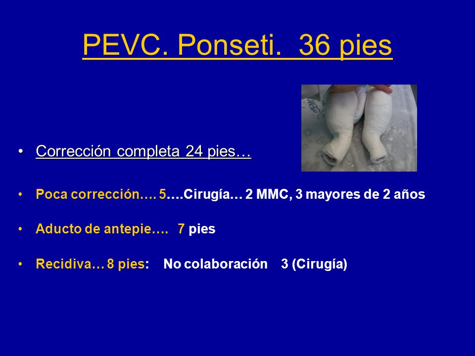 PEVC. Ponseti. 36 pies Corrección completa 24 pies…