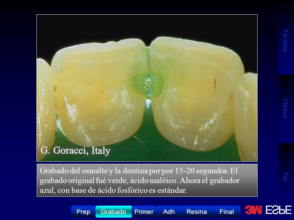 Grabado del esmalte y la dentina por por segundos