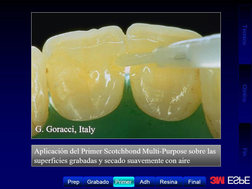 Aplicación del Primer Scotchbond Multi-Purpose sobre las superficies grabadas y secado suavemente con aire