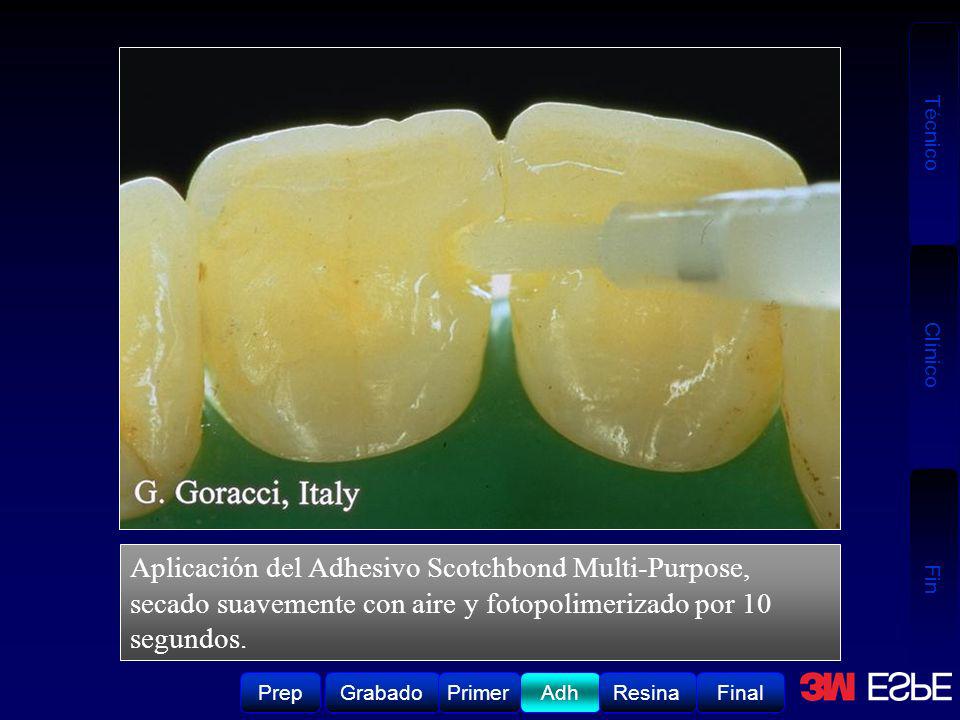 Aplicación del Adhesivo Scotchbond Multi-Purpose, secado suavemente con aire y fotopolimerizado por 10 segundos.