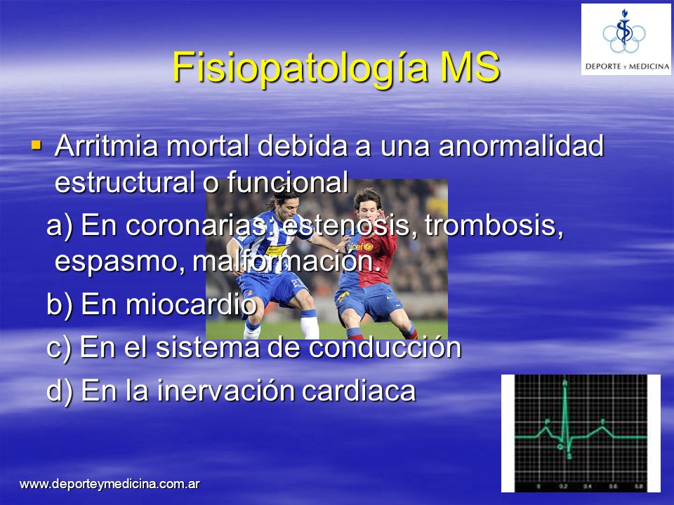 Fisiopatología MS Arritmia mortal debida a una anormalidad estructural o funcional. a) En coronarias: estenosis, trombosis, espasmo, malformación.