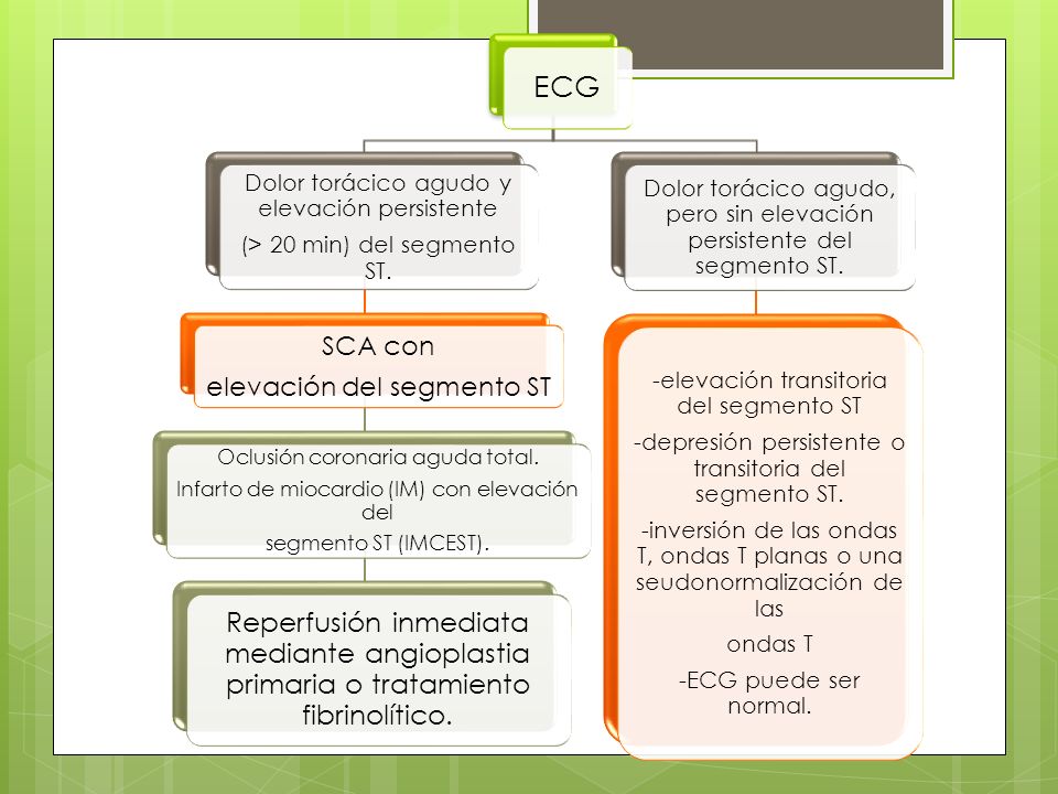 ECG Dolor torácico agudo y elevación persistente. (> 20 min) del segmento ST. SCA con. elevación del segmento ST.