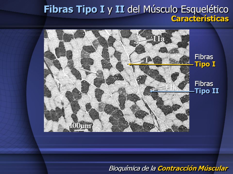 Fibras Tipo I y II del Músculo Esquelético Características