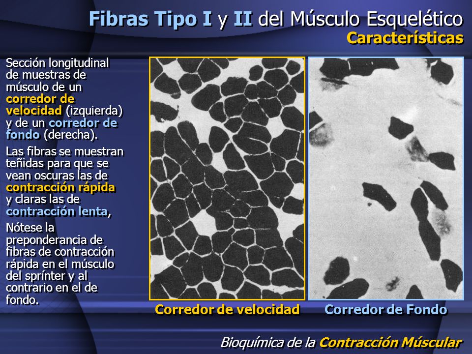 Fibras Tipo I y II del Músculo Esquelético Características