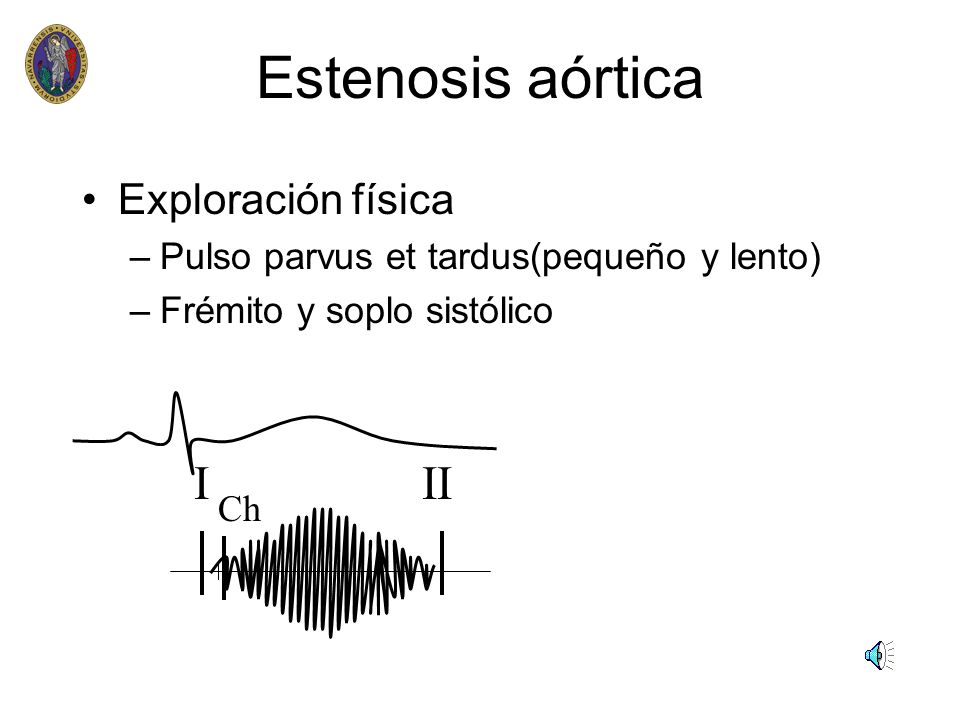 Estenosis aórtica I II Exploración física