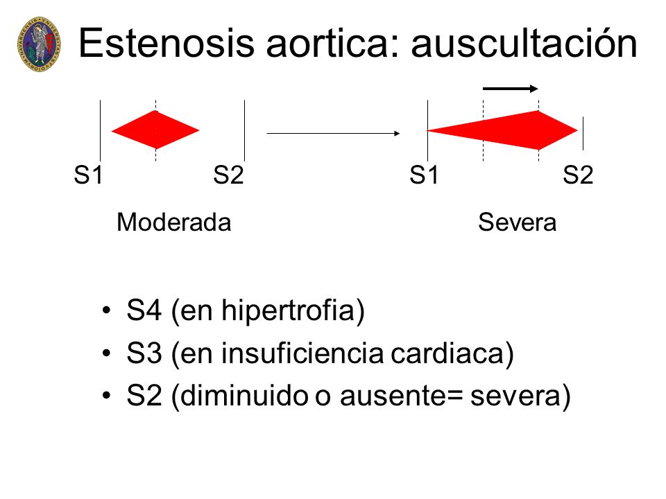 Estenosis aortica: auscultación