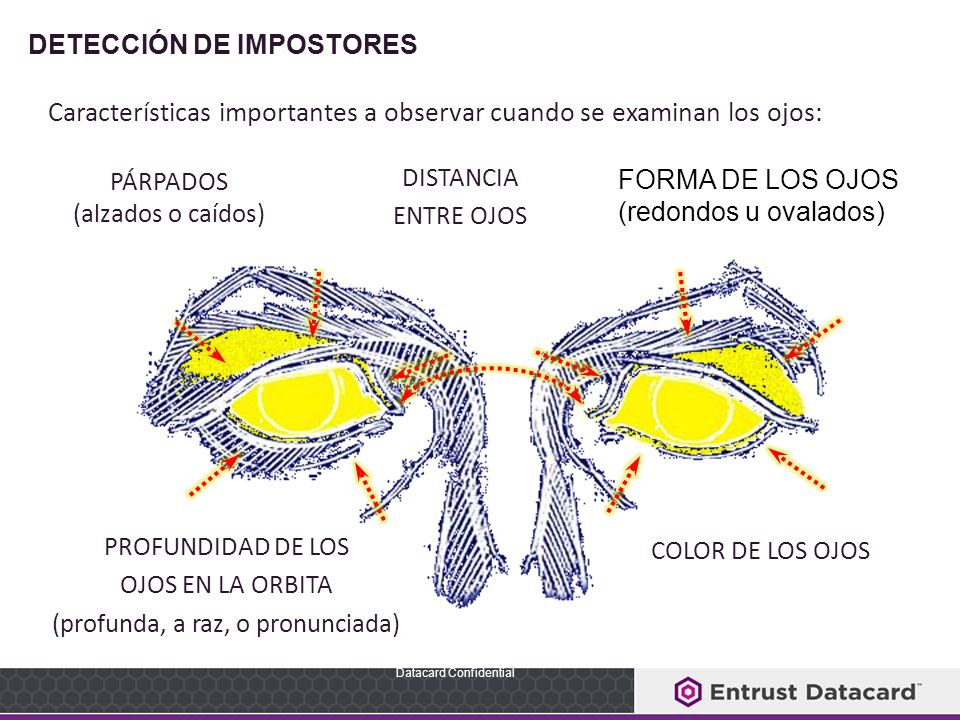 Características importantes a observar cuando se examinan los ojos: