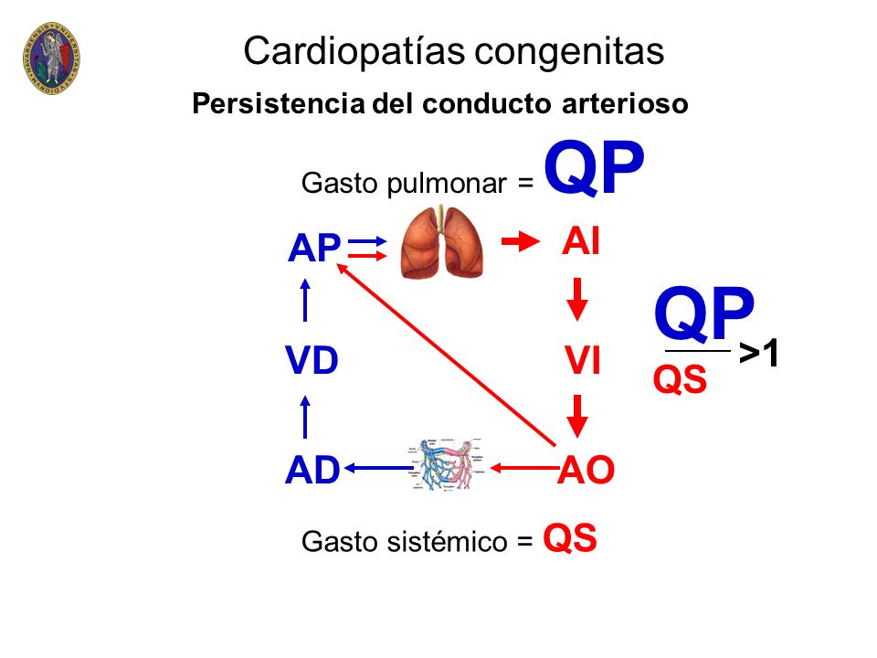 QP Cardiopatías congenitas AI AP QS >1 VD VI AD AO