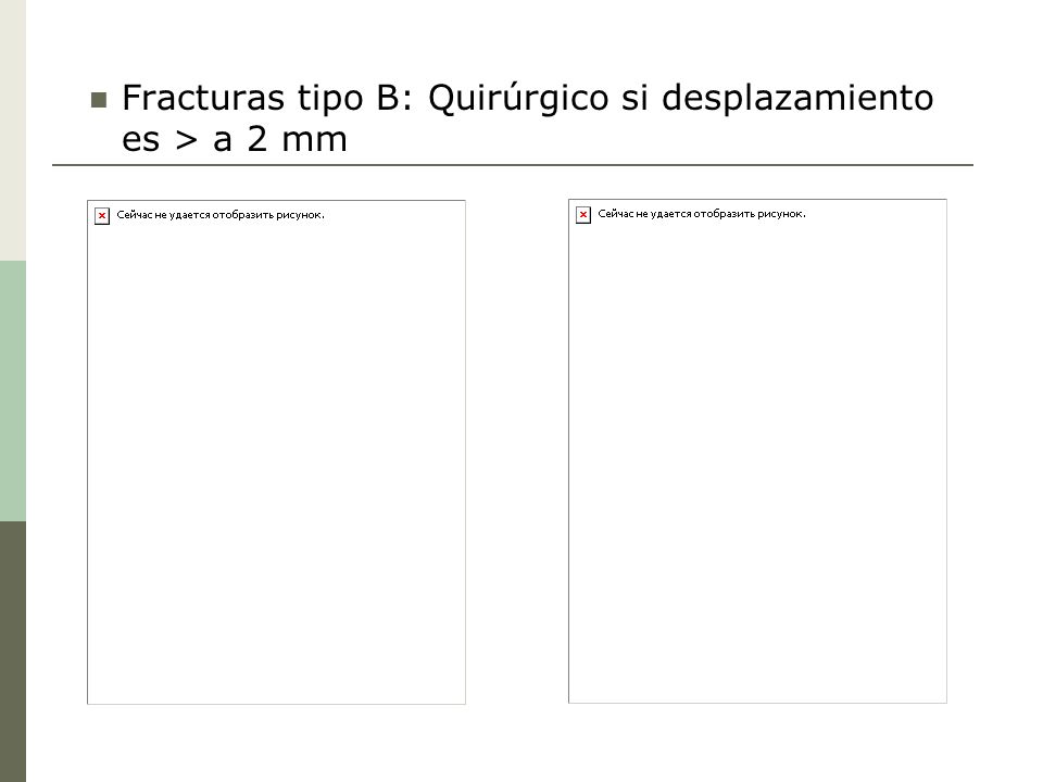 Fracturas tipo B: Quirúrgico si desplazamiento es > a 2 mm