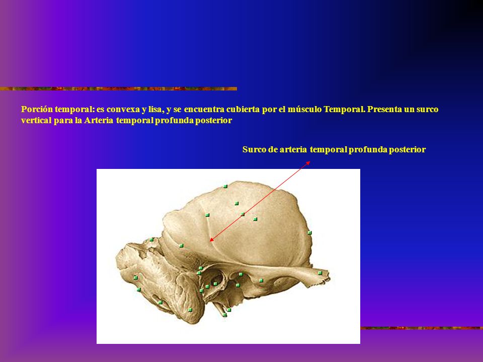 Porción temporal: es convexa y lisa, y se encuentra cubierta por el músculo Temporal. Presenta un surco vertical para la Arteria temporal profunda posterior