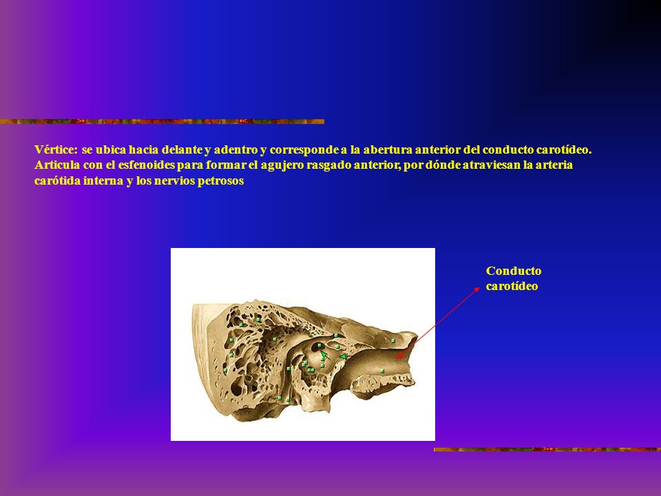 Vértice: se ubica hacia delante y adentro y corresponde a la abertura anterior del conducto carotídeo. Articula con el esfenoides para formar el agujero rasgado anterior, por dónde atraviesan la arteria carótida interna y los nervios petrosos
