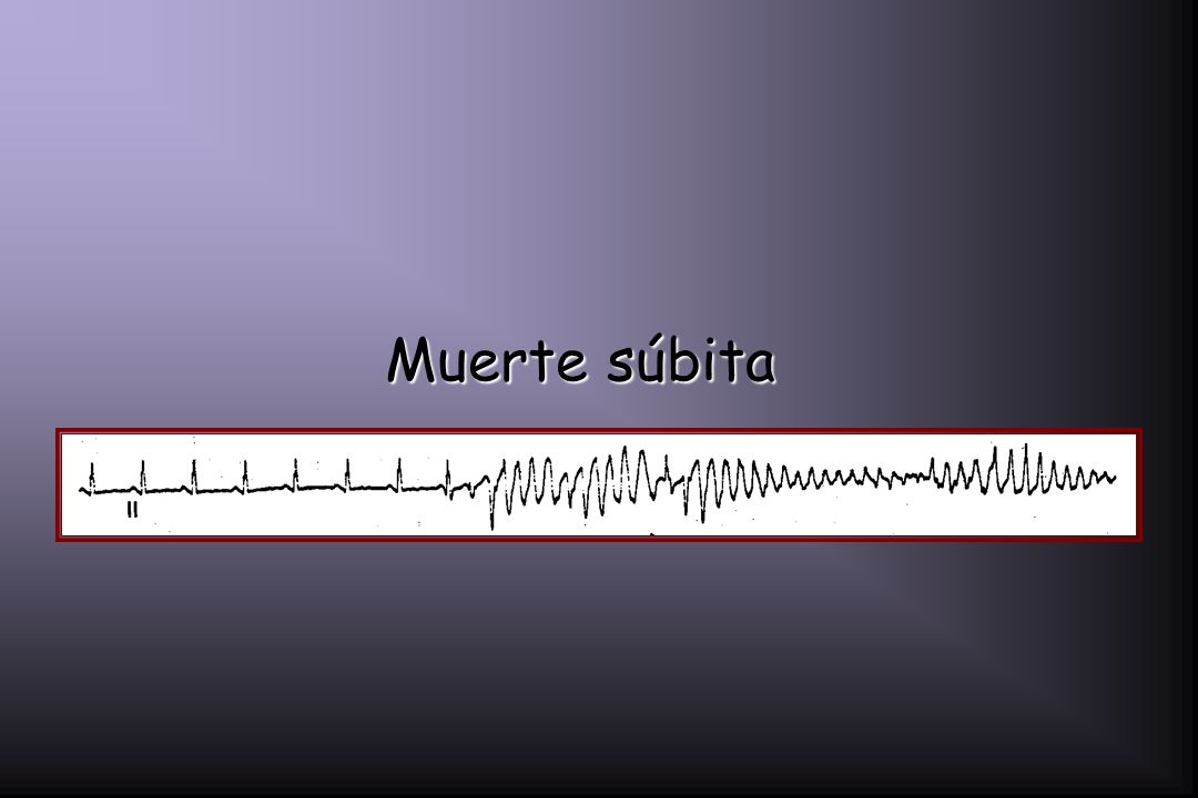 Muerte súbita