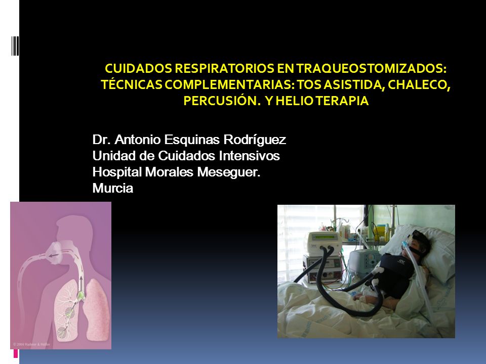 CUIDADOS RESPIRATORIOS EN TRAQUEOSTOMIZADOS: TÉCNICAS COMPLEMENTARIAS: TOS ASISTIDA, CHALECO, PERCUSIÓN. Y HELIO TERAPIA