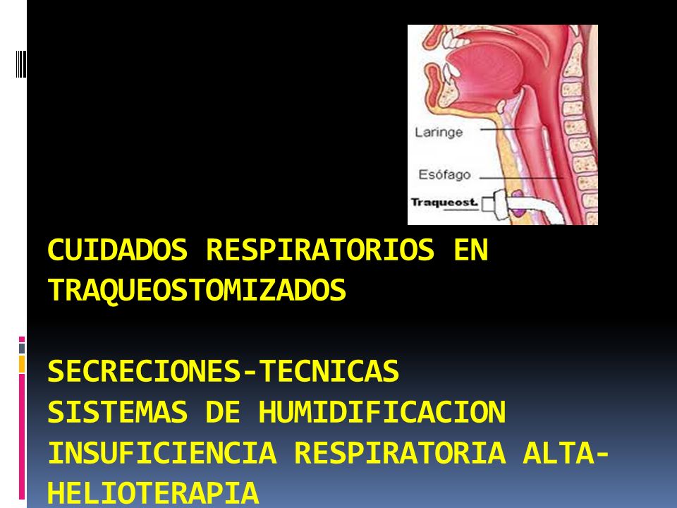 CUIDADOS RESPIRATORIOS EN TRAQUEOSTOMIZADOS SECRECIONES-TECNICAS SISTEMAS DE HUMIDIFICACION INSUFICIENCIA RESPIRATORIA ALTA-HELIOTERAPIA